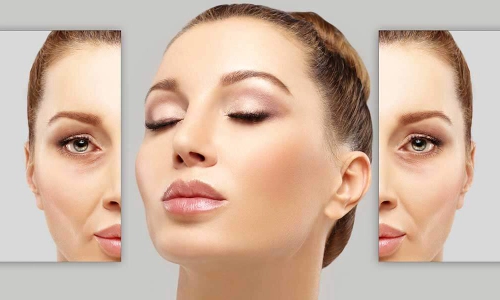 برای خط اخم فیلر بهتره یا بوتاکس؟