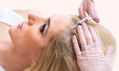 مزوتراپی چیست و چرا محبوب شده است؟